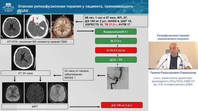 Реперфузионная терапия ишемического инсульта Рамазанов Г.Р.