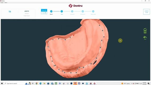 FREE denture software! Thank you Truabutment!