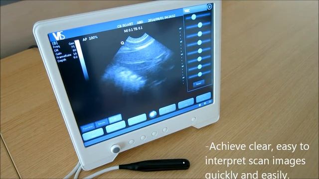 VIS Scan Pad Veterinary Ultrasound Machine