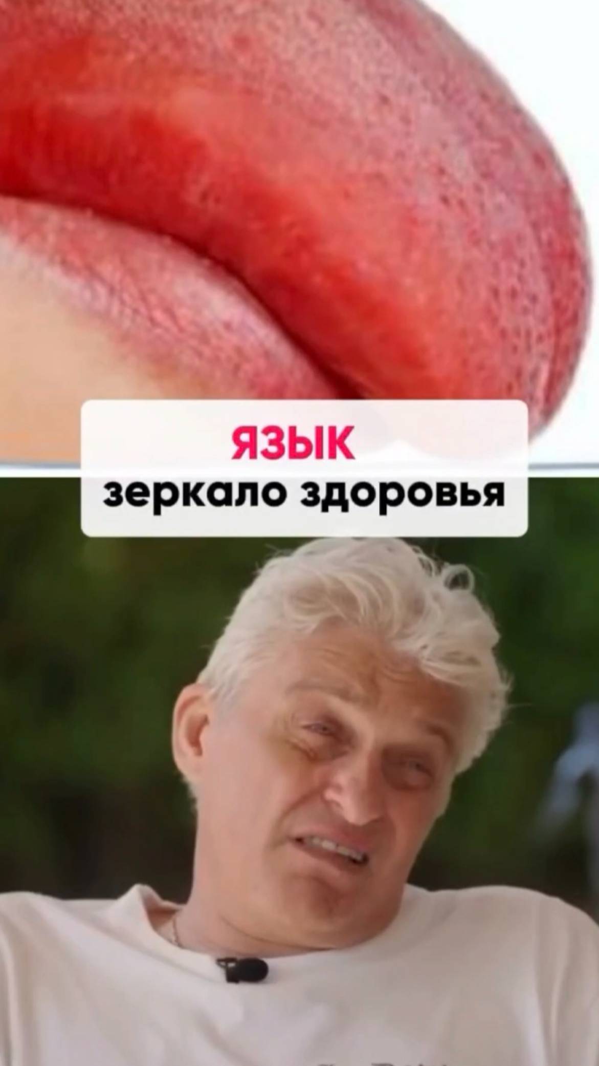 Язык - зеркало здоровья #shorts.mp4