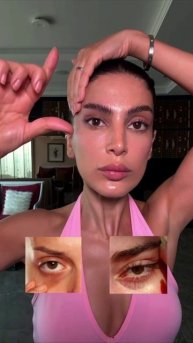 Массаж лица заменит блефаропластику!