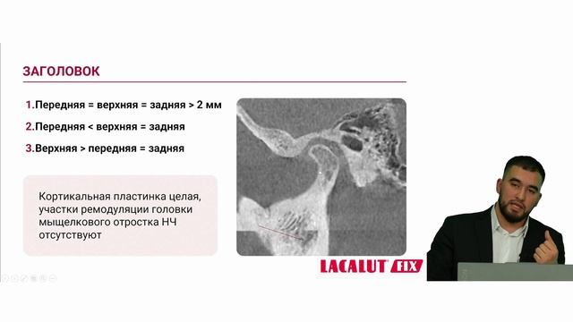 «Цифровая гнатология: лечение пациентов с ДВНЧС в цифровом протоколе». Теоретическая часть