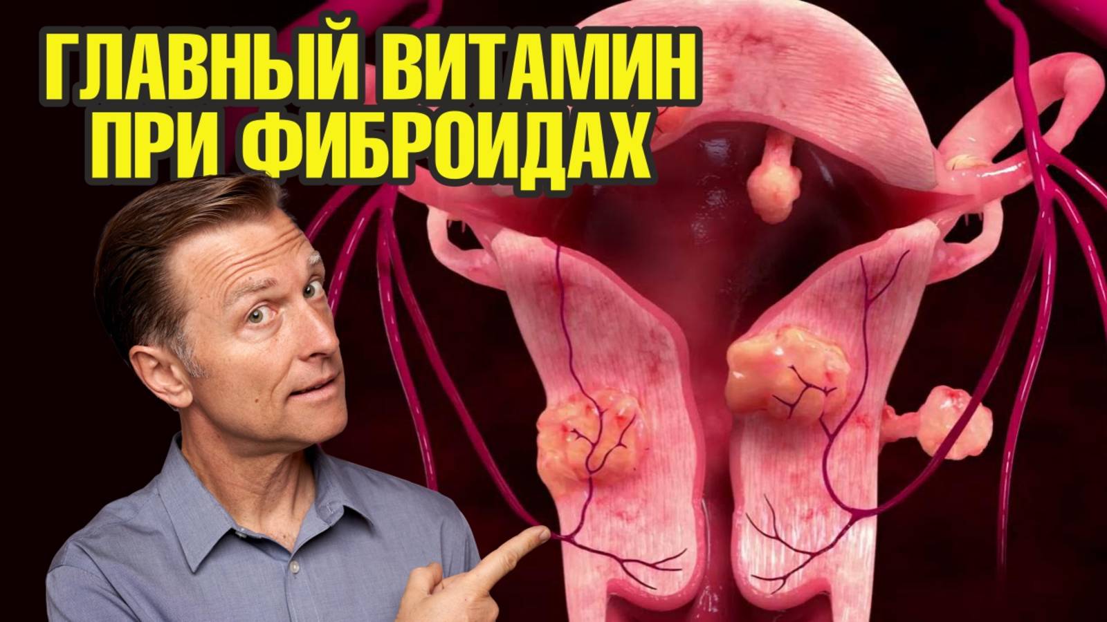 Миома матки: этот витамин поможет уменьшить миому🧐Доказано!