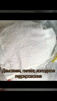 Чистка лица