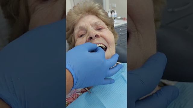 Съёмный биофункциональный протез. Работа доктора Халимова Д.З.
