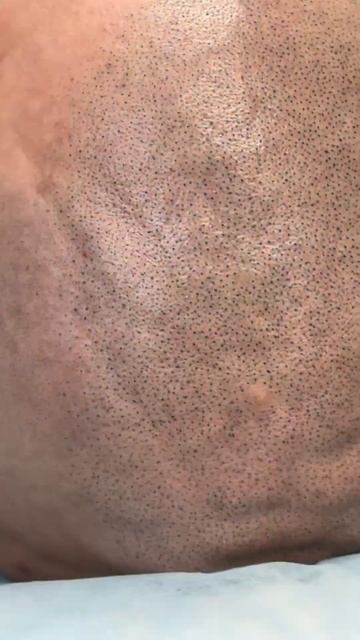 Scalpmicropigmentation или тату волос? #scalpmicropigmentation #татуволос #трихопигментация #smp