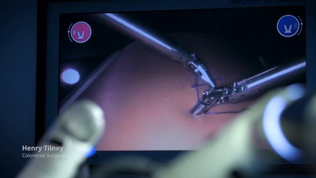 CMR Surgical's robot Versius: The Surgeon's Perspective