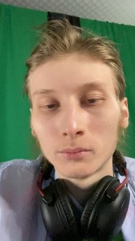 ВЫЛЕЧИЛ ОЧЕРЕДНОЙ ЗУБ ОТ КАРИЕСА! ЕШЬТЕ ПРАВИЛЬНО,ЧИСТИТЕ ЗУБЫ И БУДЬТЕ ЗДОРОВЫ❤️ / ОЧИСТКА