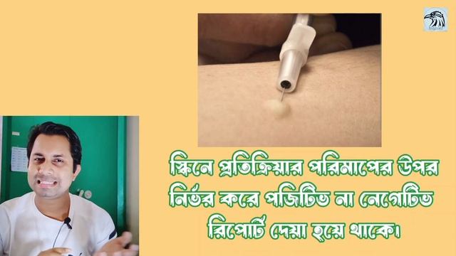 যক্ষা হলে কি পরীক্ষা করা হয় | Mantoux Test কিভাবে করে