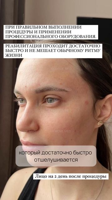 ПЛАЗМА ПЭН vs. ХОЛОДНАЯ ПЛАЗМА