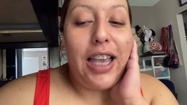First Week With BRACES | Overjet-Overbite | Damon Braces