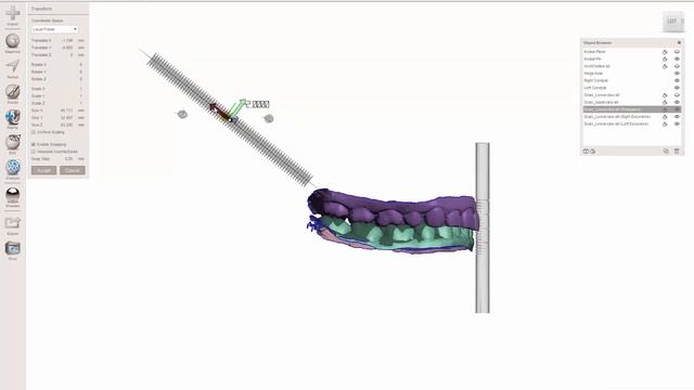 MeshMixer: Virtual Semi-Adjustable Articulator
