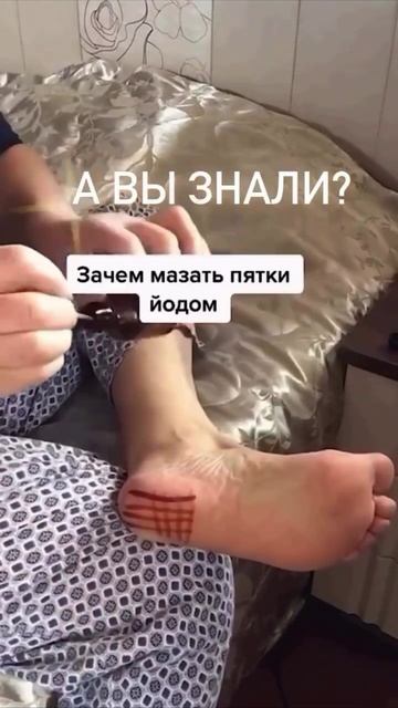 Мажем пятки йодом 🦶