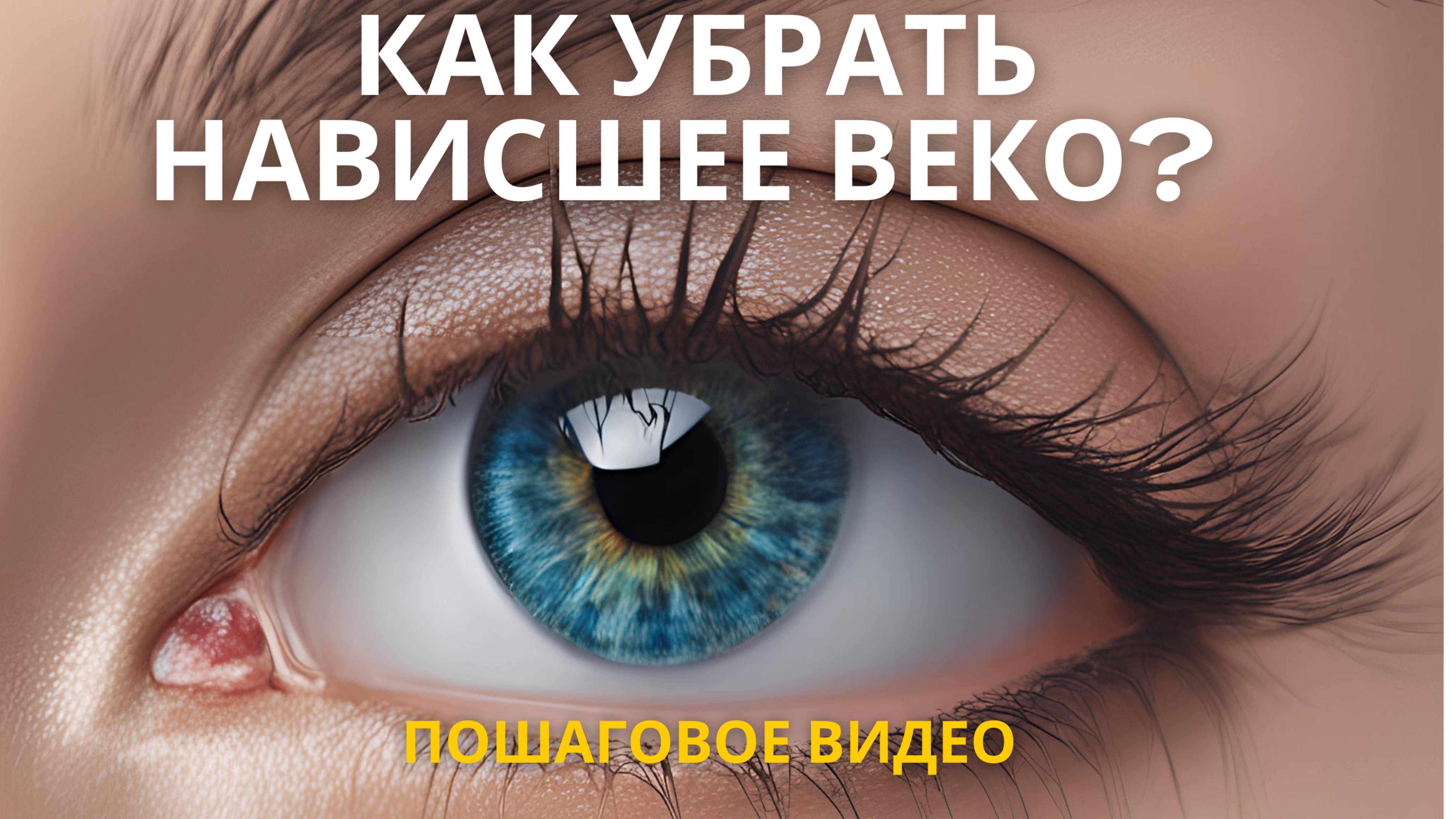 Как убрать нависшее веко?