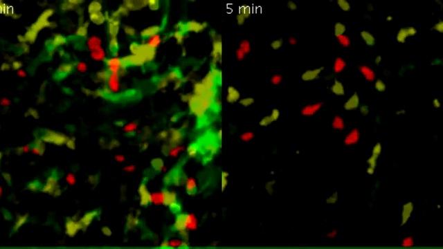 (two-photon laser scanning microscopy) Intravital imaging of T-cellDC interactions in lymph nodes.