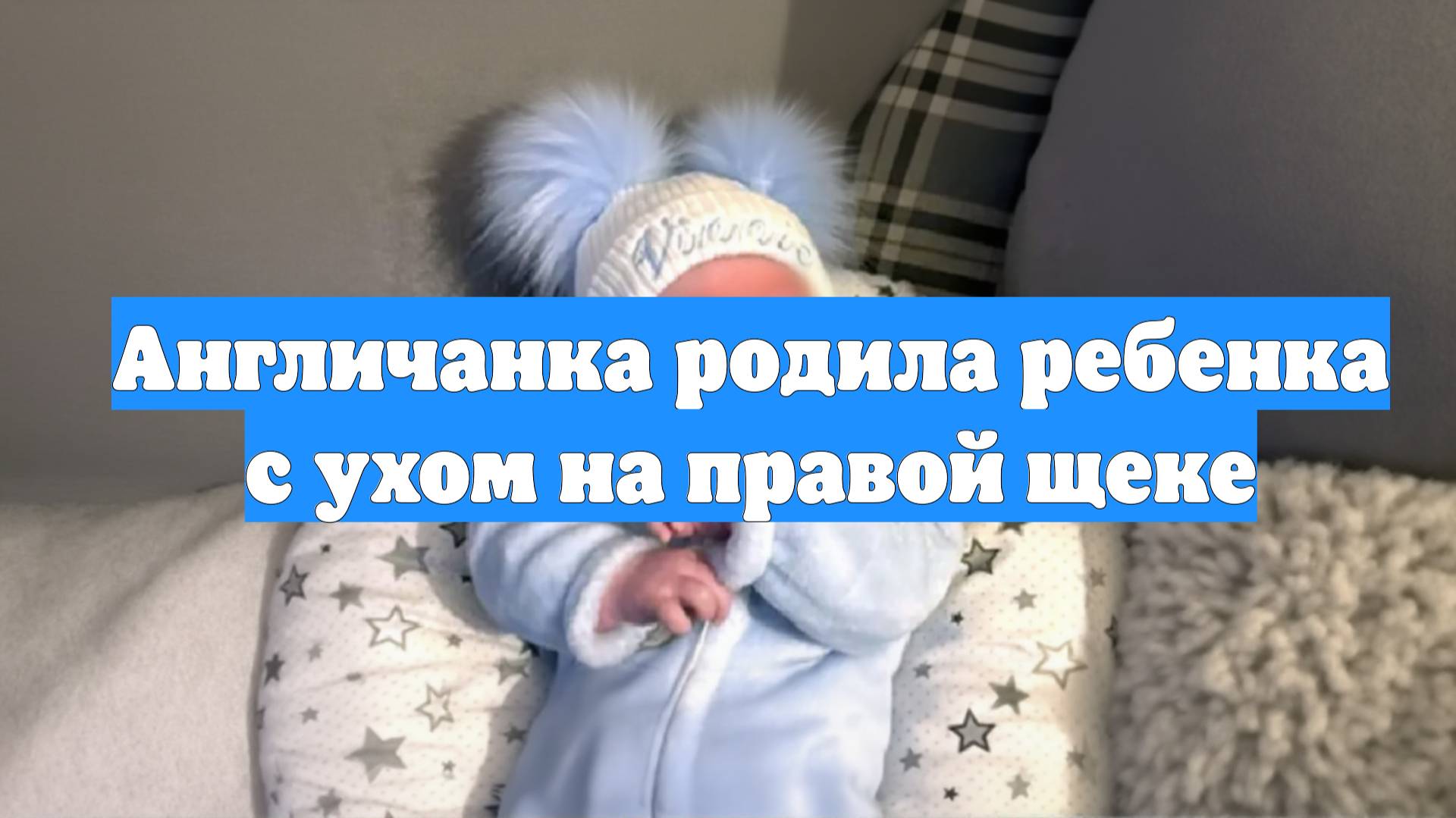 Англичанка родила ребенка с ухом на правой щеке