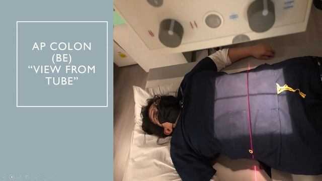 AP COLON VIDEO