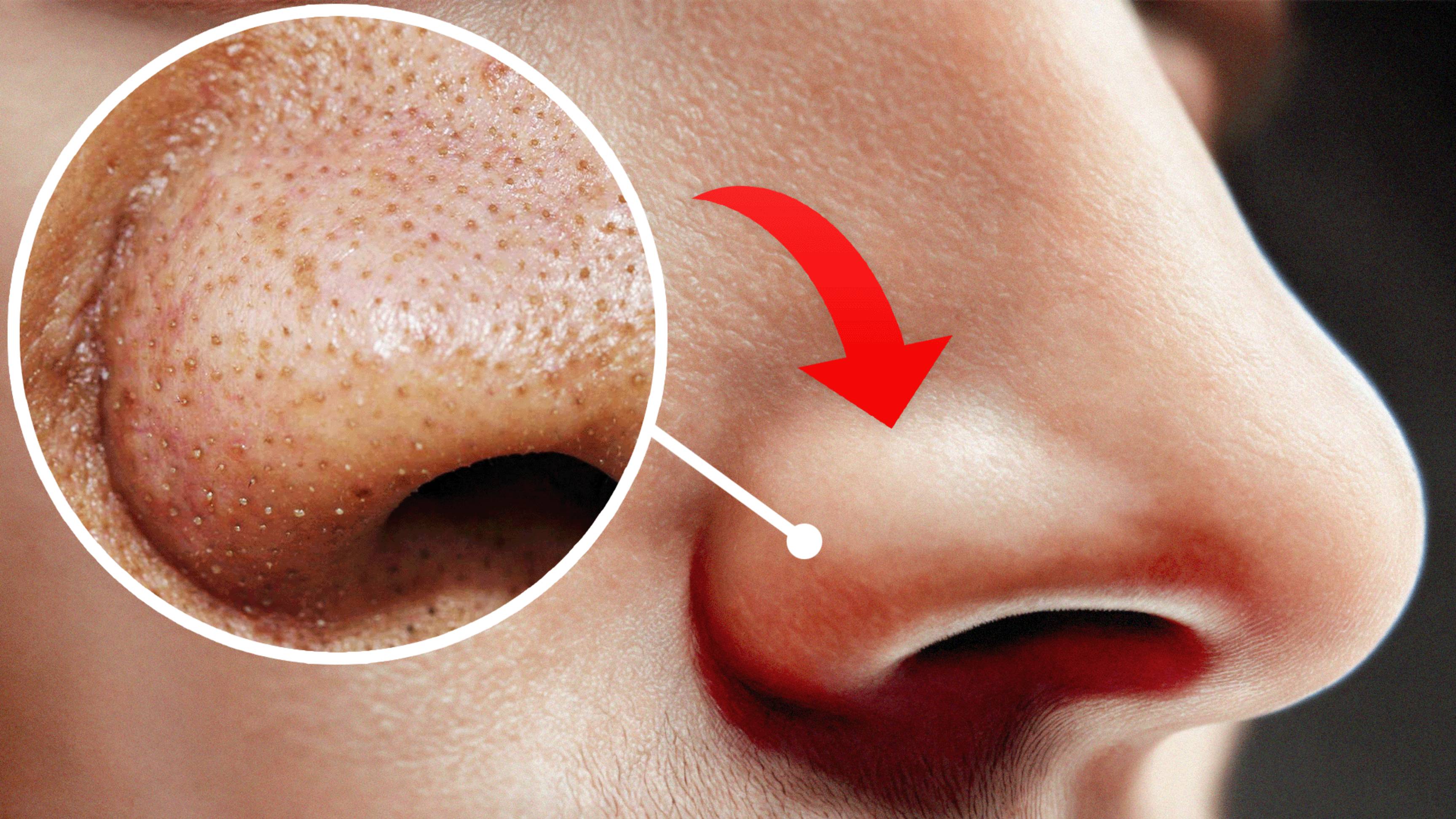 6 ПРИВЫЧЕК, КОТОРЫЕ УБИВАЮТ ТВОЮ КОЖУ! 🚨🔥