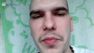 миноксидил для волос и бороды онлайн видеодневник 1 месяц применения миноксидила