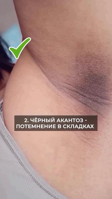 Бесплатный Мини-курс «Основы нутрициологии»