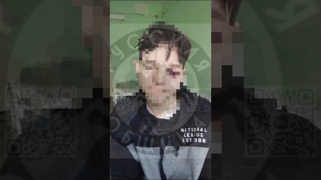 Отпрыск приезжих жестоко избил русского мальчика кастетом !!!
