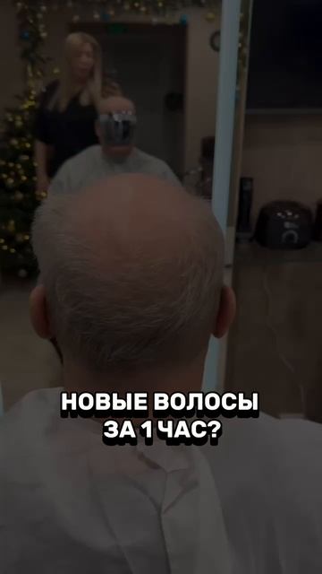 Система волос