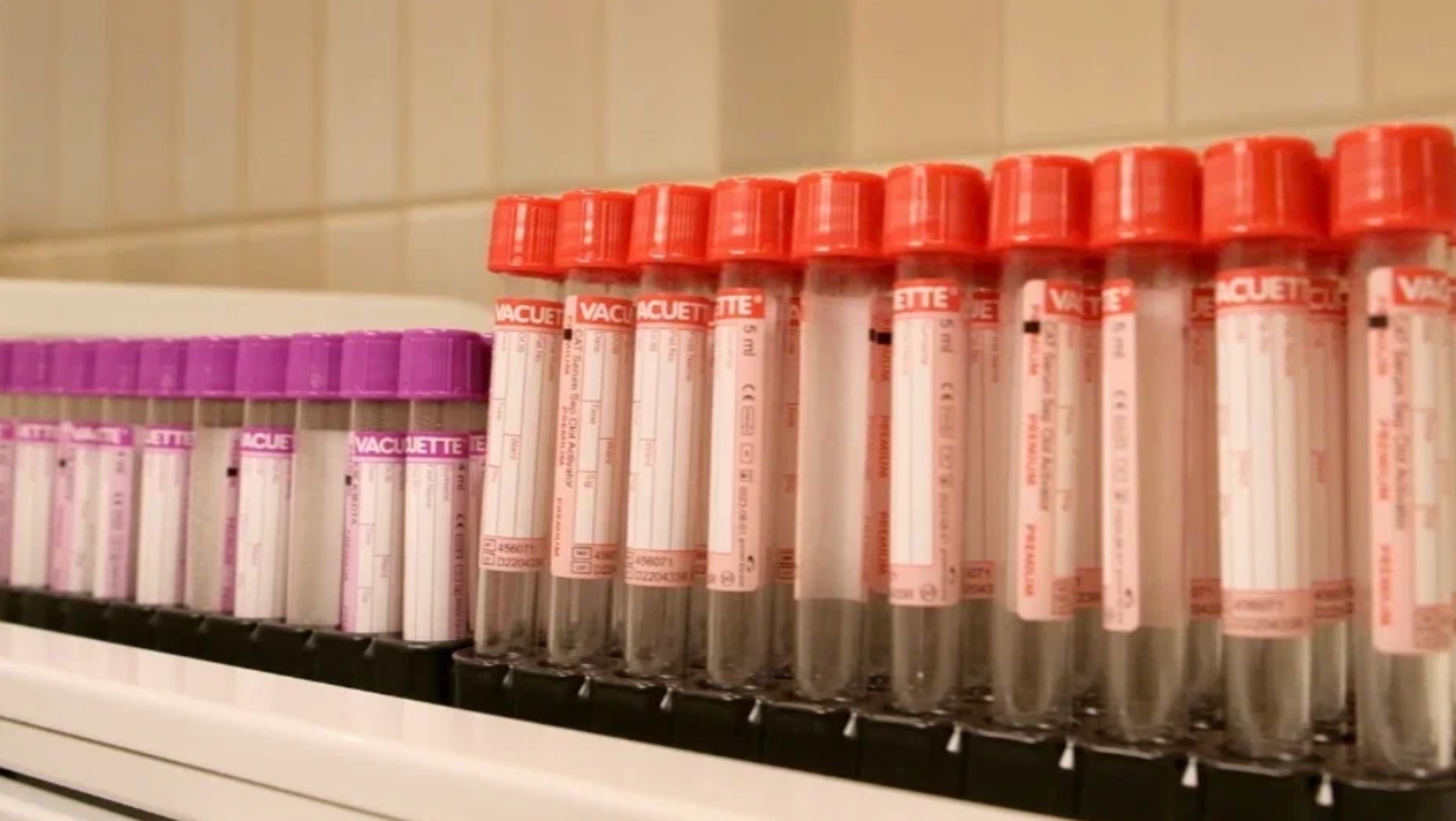 СДАЧА АНАЛИЗОВ В DIVUS 💉