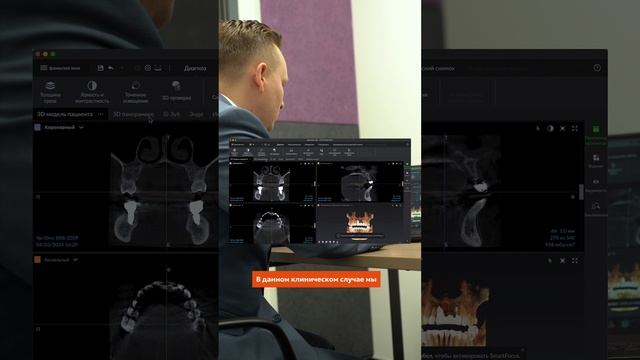 Как DTX Studio Clinic может упростить работу врача-ортопеда с КЛКТ-снимками