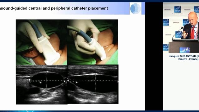 Ultrasound for the intensivist In procedures Jacques Duranteau 2018