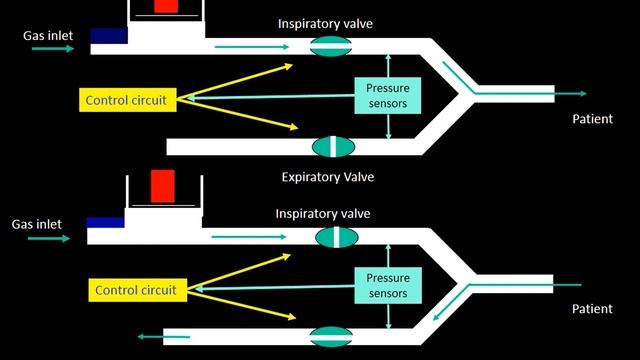 Controlled mechanical ventilation The principles Giacomo Bellani 2018