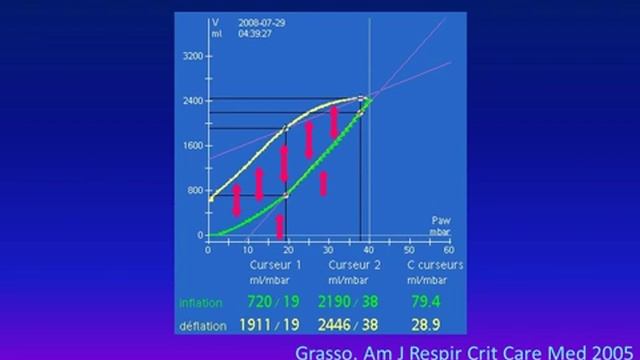 Automation in clinical practice Case studies J M Arnal 2016