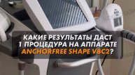 Какие результаты даст одна процедура на аппарате ANCHORFREE SHAPE V8C2