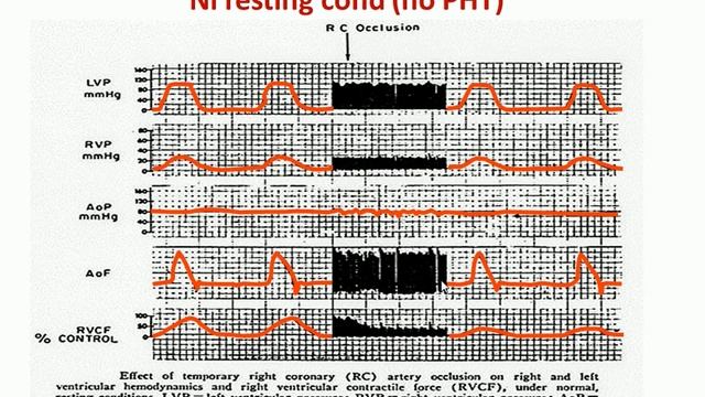 Right heart physiology Didier Payen 2014