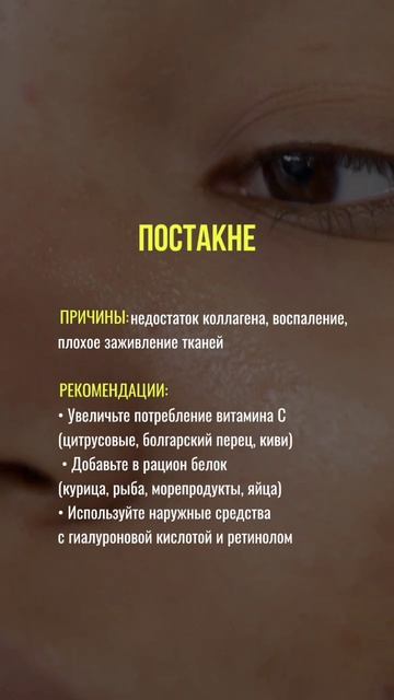 #нутрициология #нутрициолог #зож#здоровыйобразжизни #здоровье #натуропатия #натуропат #постакне