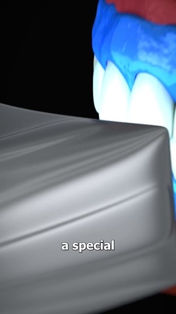 Professional Teeth Whitening 🤔 (explained)