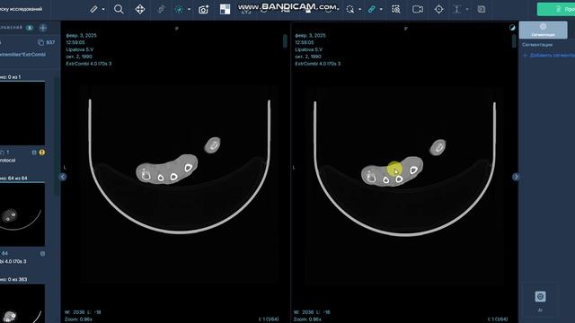Синхронизация инструмента ширина уровень ( контраст)