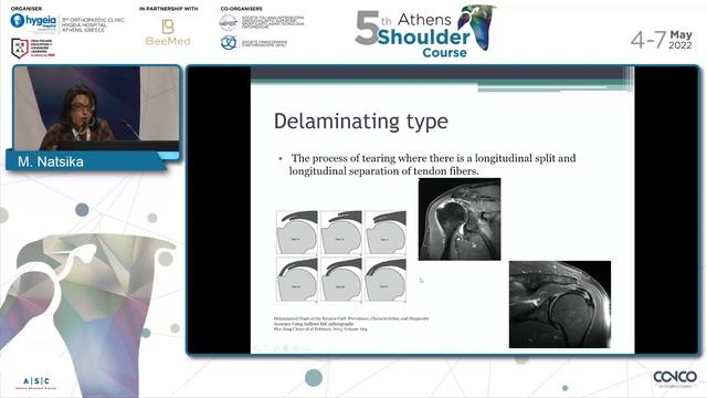The cuff pathology. The radiologist’s perspective. - Margarita Natsika