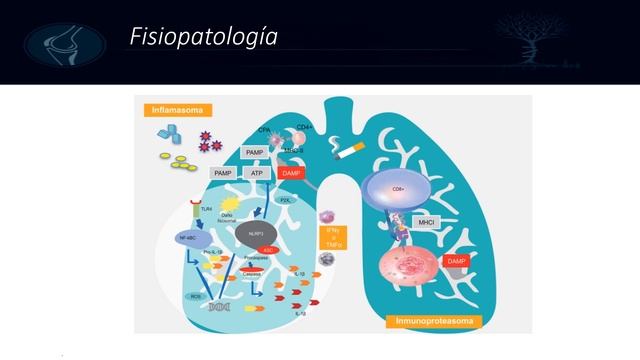 Fisiopatologia de la Enfermedad Pulmonar Obstructiva Cronica - Dr. Alvaro Ossio Ortube