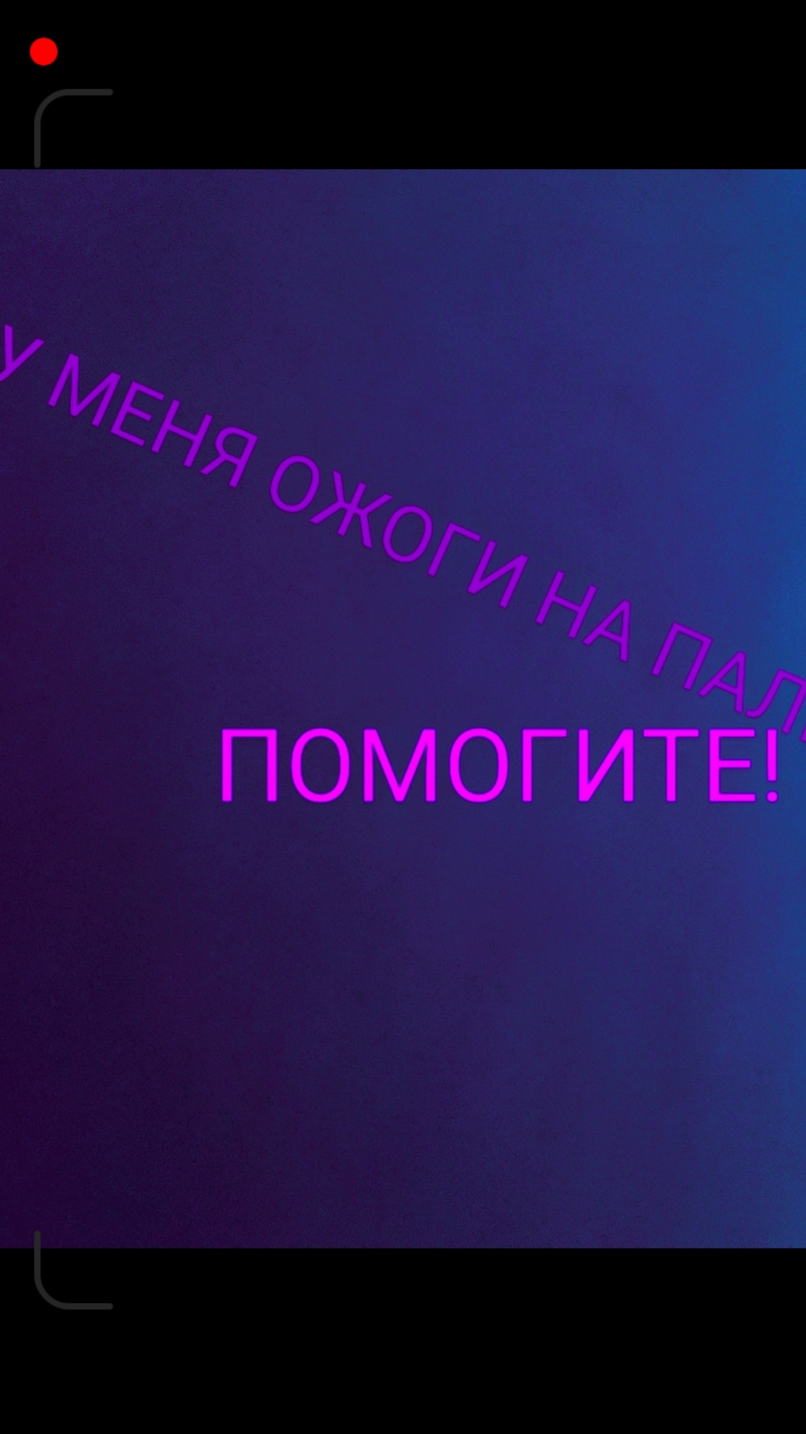 У меня на пальцах ожоги!  был пожар
