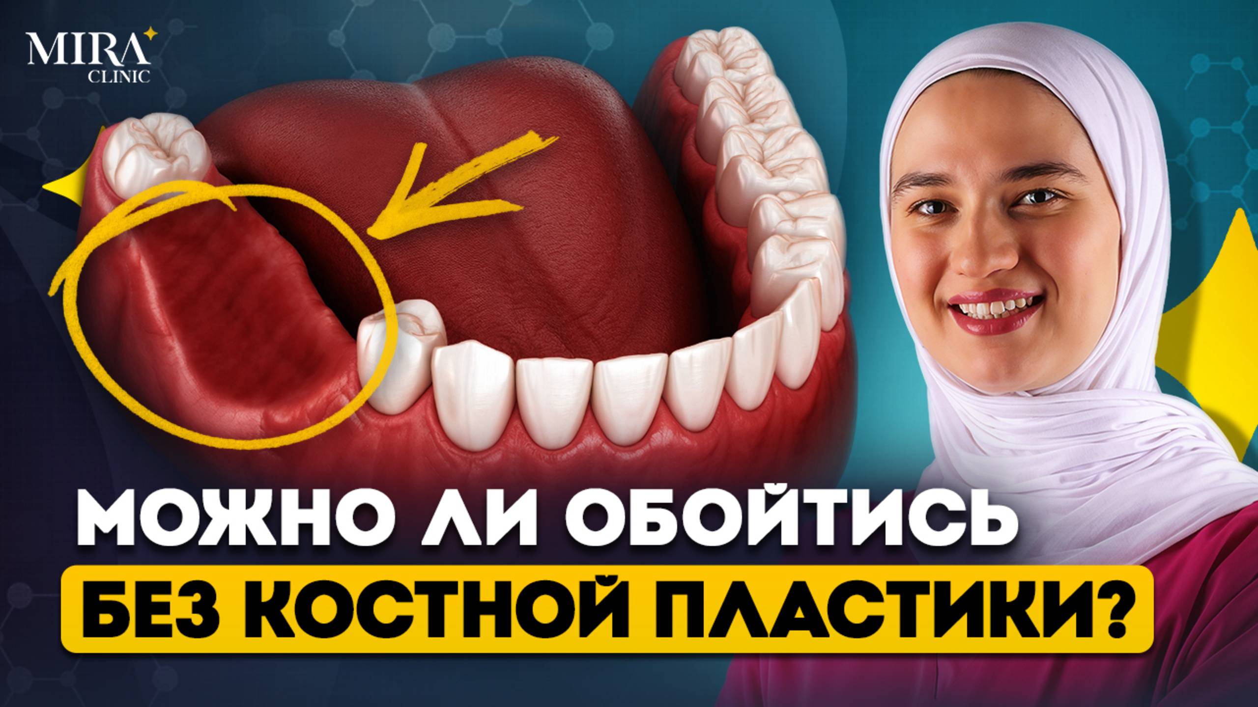 Без этого зубные ИМПЛАНТЫ НЕ ПРИЖИВУТСЯ! Нужно ли вам наращивать кость?