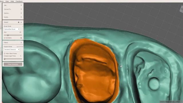 Meshmixer - Ditching Dental Model