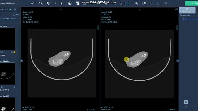Синхронизация инструмента прокручивание серии