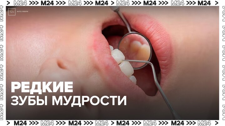 Зубы мудрости становятся редкостью среди зумеров - Москва 24