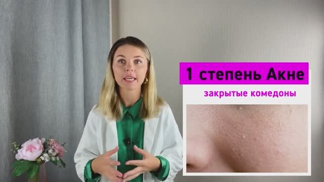 Акне! Что со мной. Виды прыщей. Проблемная кожа