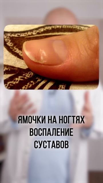 Проверь свои ногти! Диагностика по ногтям #shorts