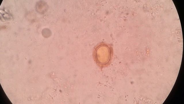Ascaris lumbricoides / Roundworm