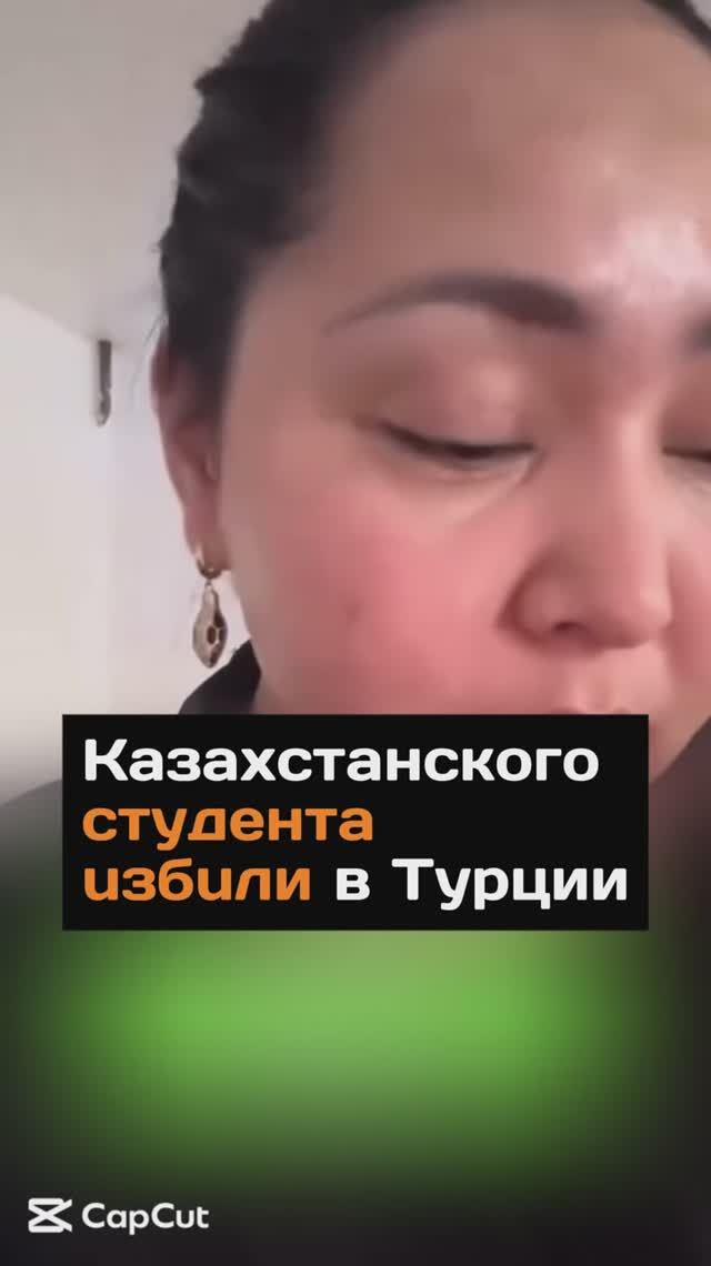 Студента из Казахстана избили в Турции