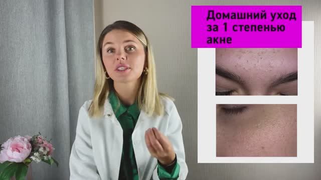 Прыщи как лечить