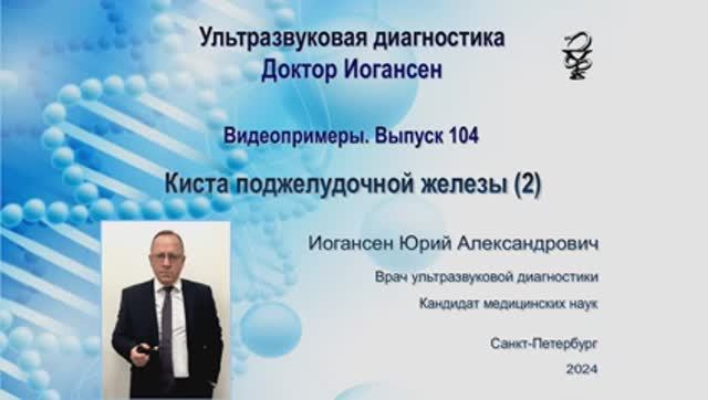 УЗИ. Доктор Иогансен. Видеопримеры. Выпуск 104. Киста поджелудочной железы (2).