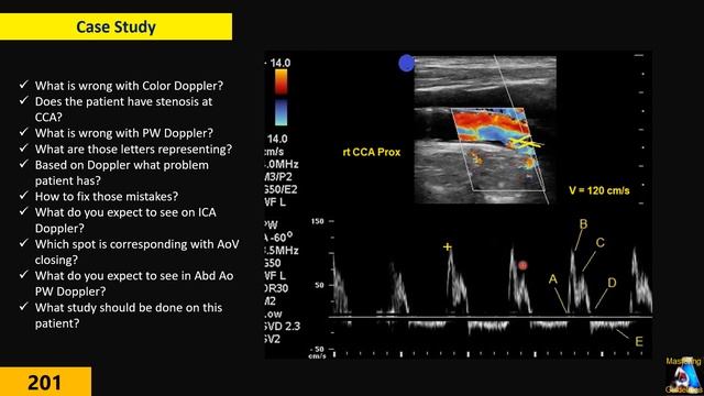 General Concepts of Doppler, Optimizing, Normal & Abnormal Patterns